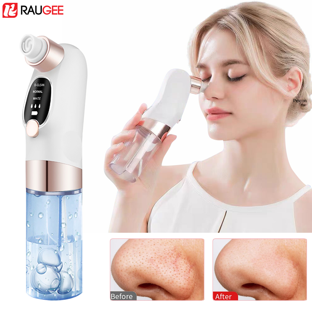 Air Bubble Remover - Estrattore di punti neri Estrattore di