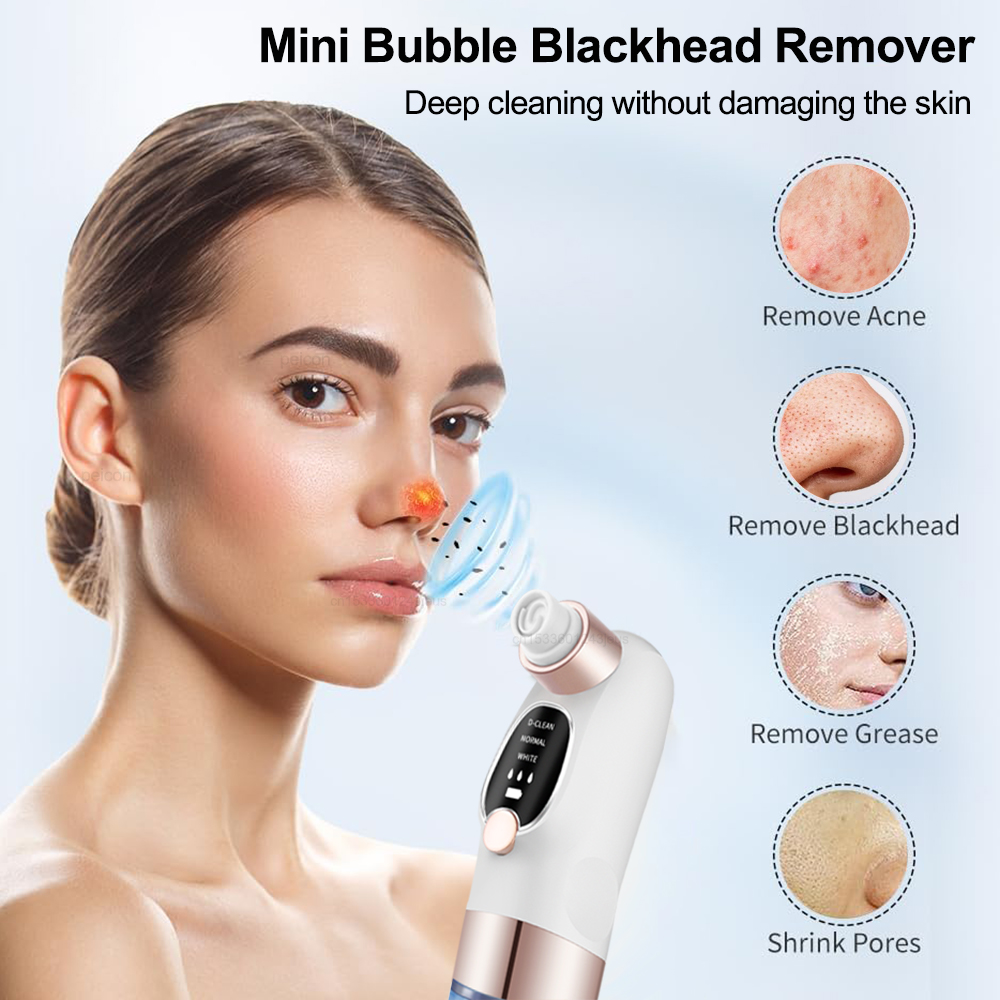 Estrattore di punti neri Estra - Air Bubble Remover recensione e prezzo